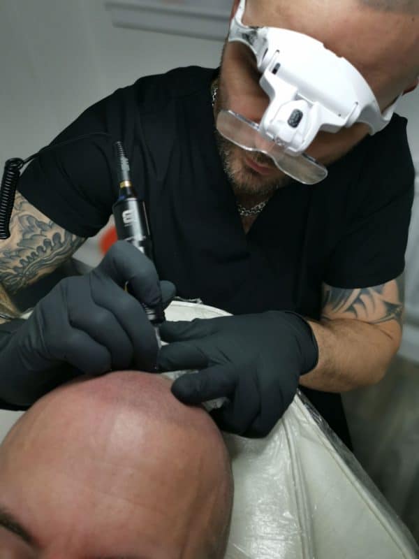 Scalp Micropigmentation Blog