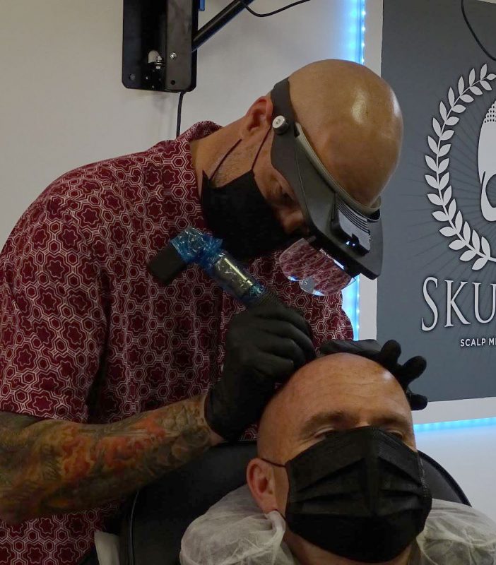 Scalp Micropigmentation Blog