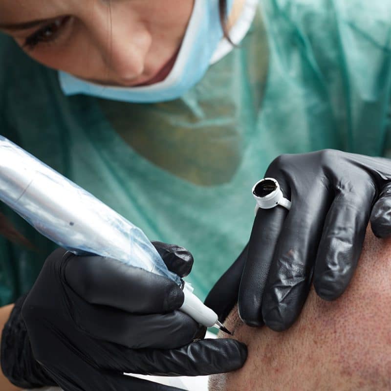 Scalp Micropigmentation Blog