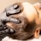 Can scalp micropigmentation be done on all skin types and hair colors