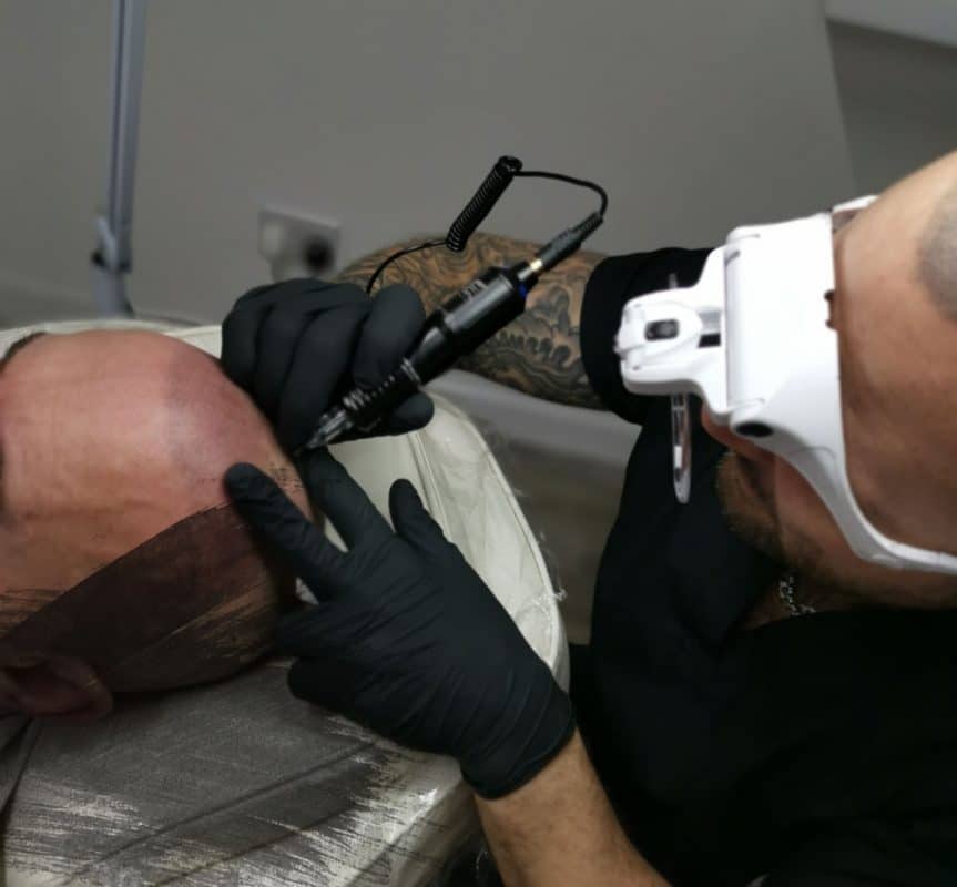 Scalp Micropigmentation Blog