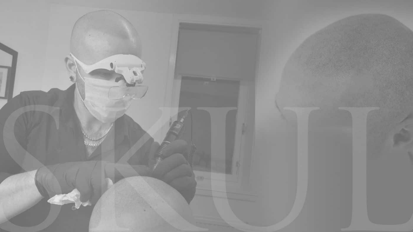 Scalp Micropigmentation Blog