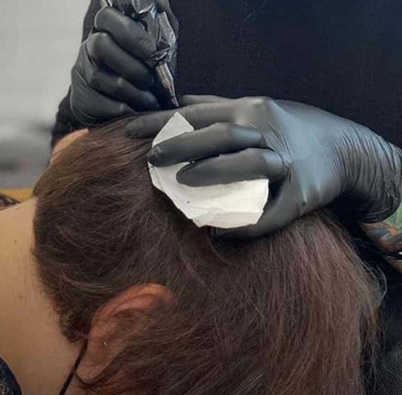 Scalp Micropigmentation Blog