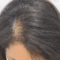 Is scalp micropigmentation a permanent solution