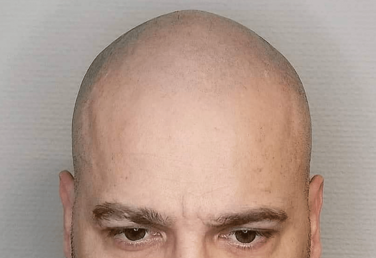 Is Your Diet The Reason Behind Your Hair Loss