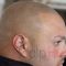 Life after Scalp Micropigmentation. How SMP change lives.